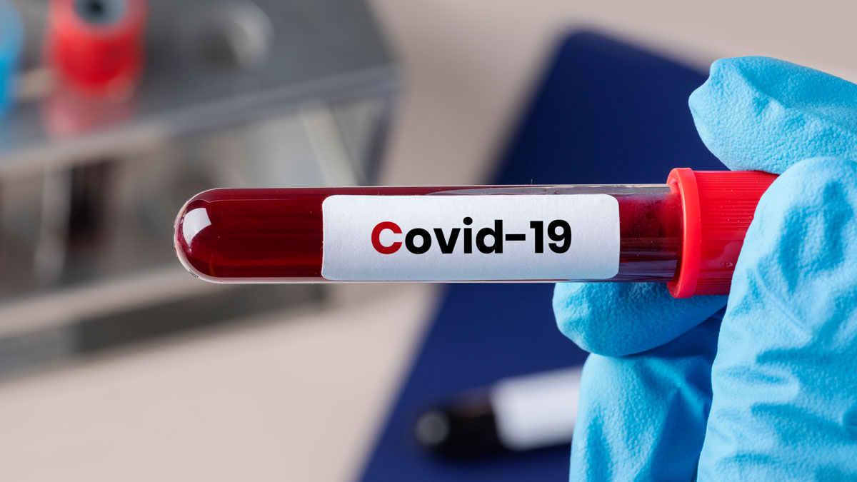 В руке у врача пробирка с кровью с надписью Covid-19
